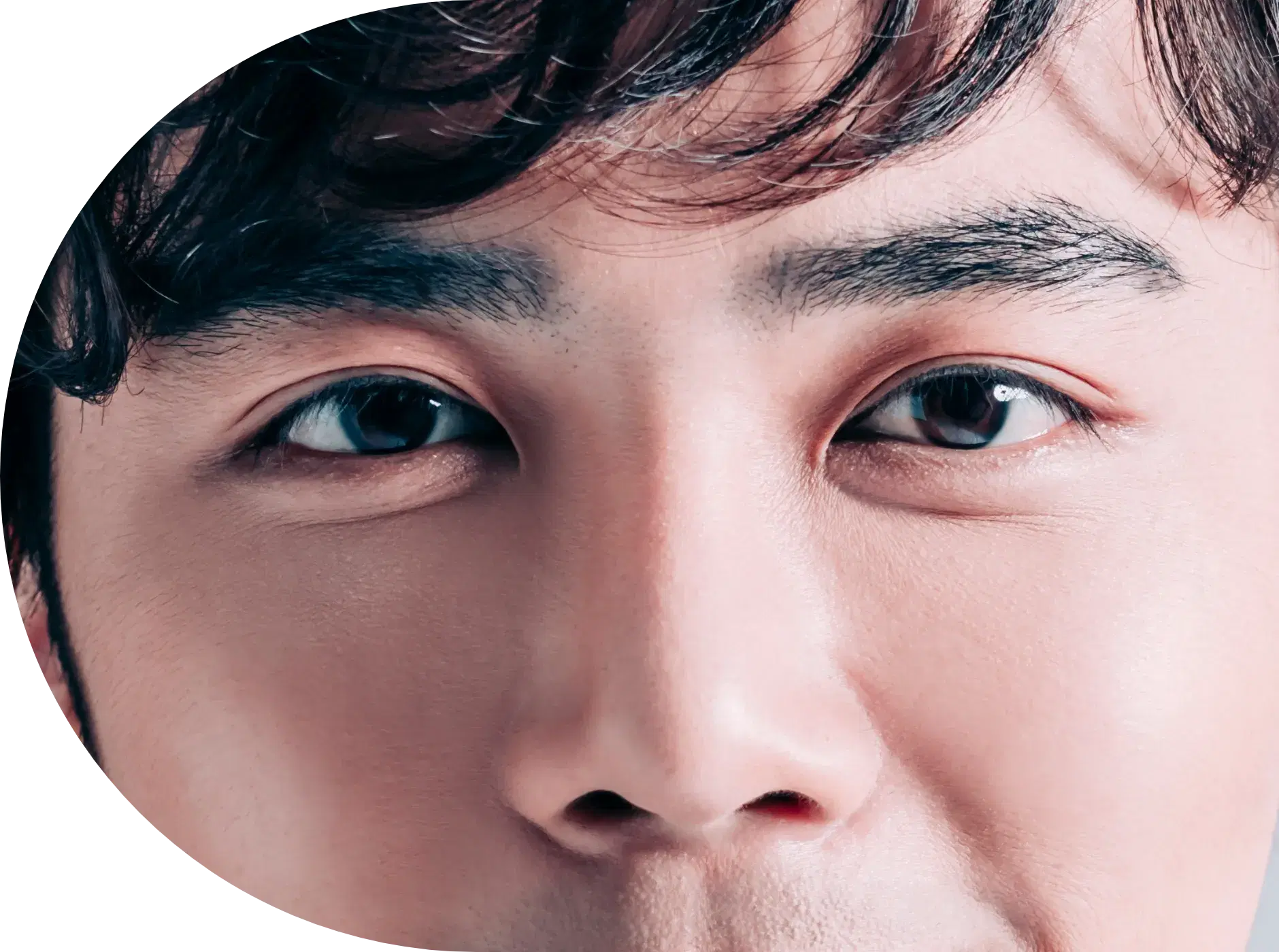 Male eyelid surgery in Korea - creating open, youthful eyes with expert precision