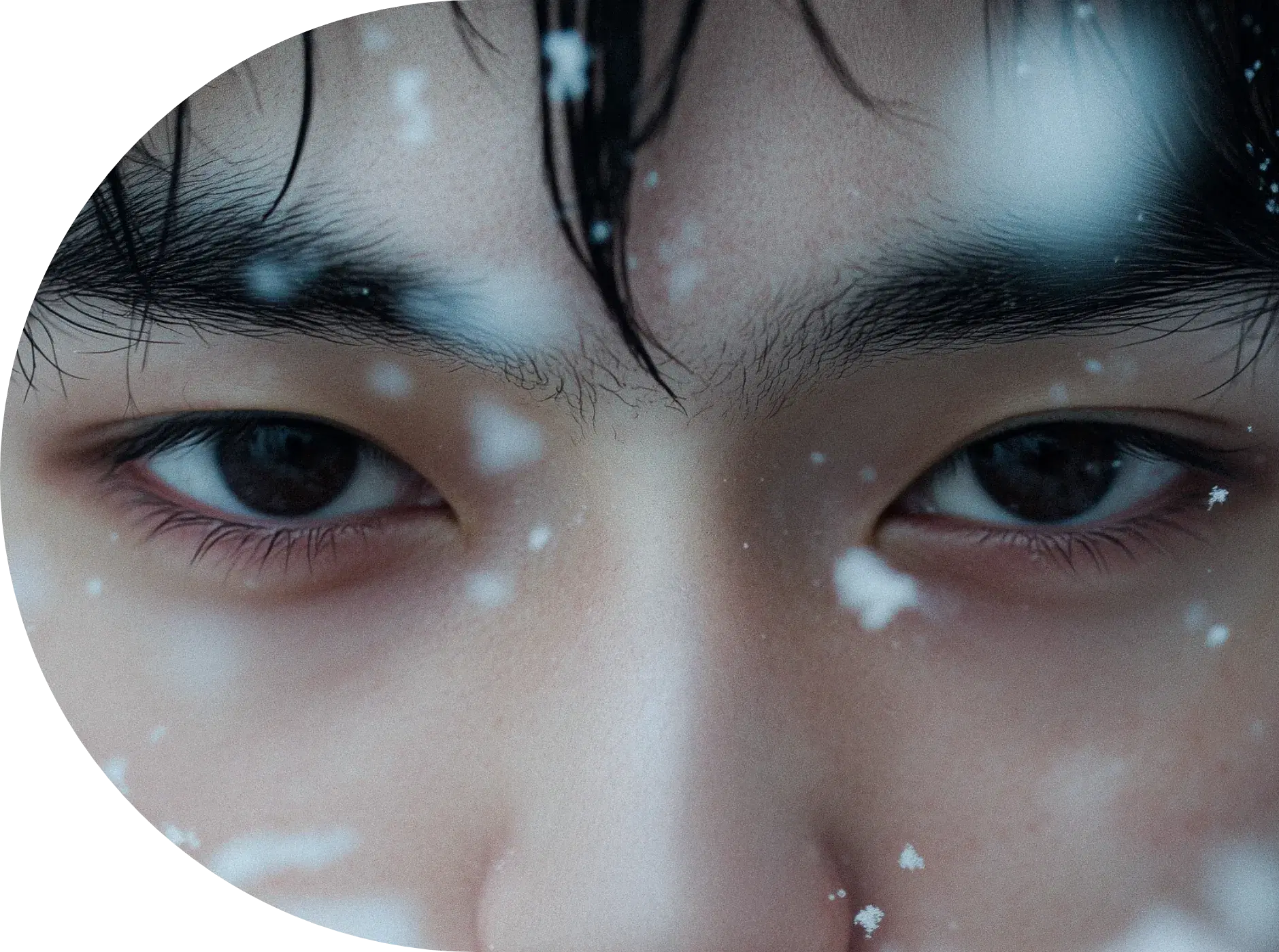 남자 눈매교정를 통한 인상의 변화