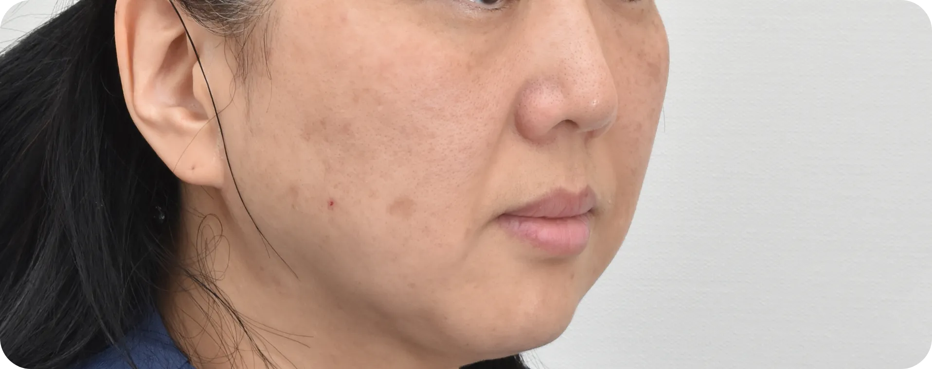 BBL-히어로-효과