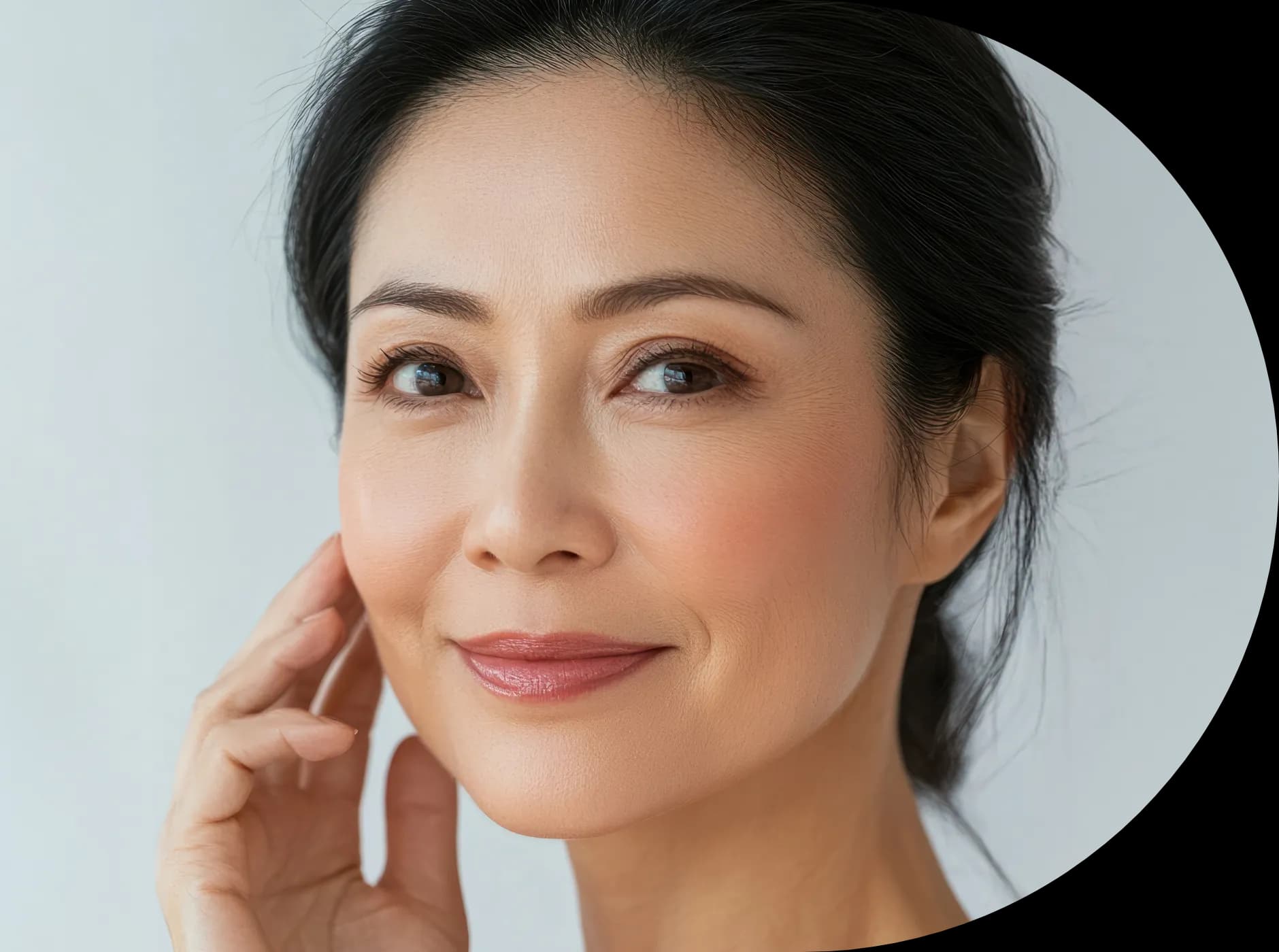 mouth wrinkles can be treated with facelift