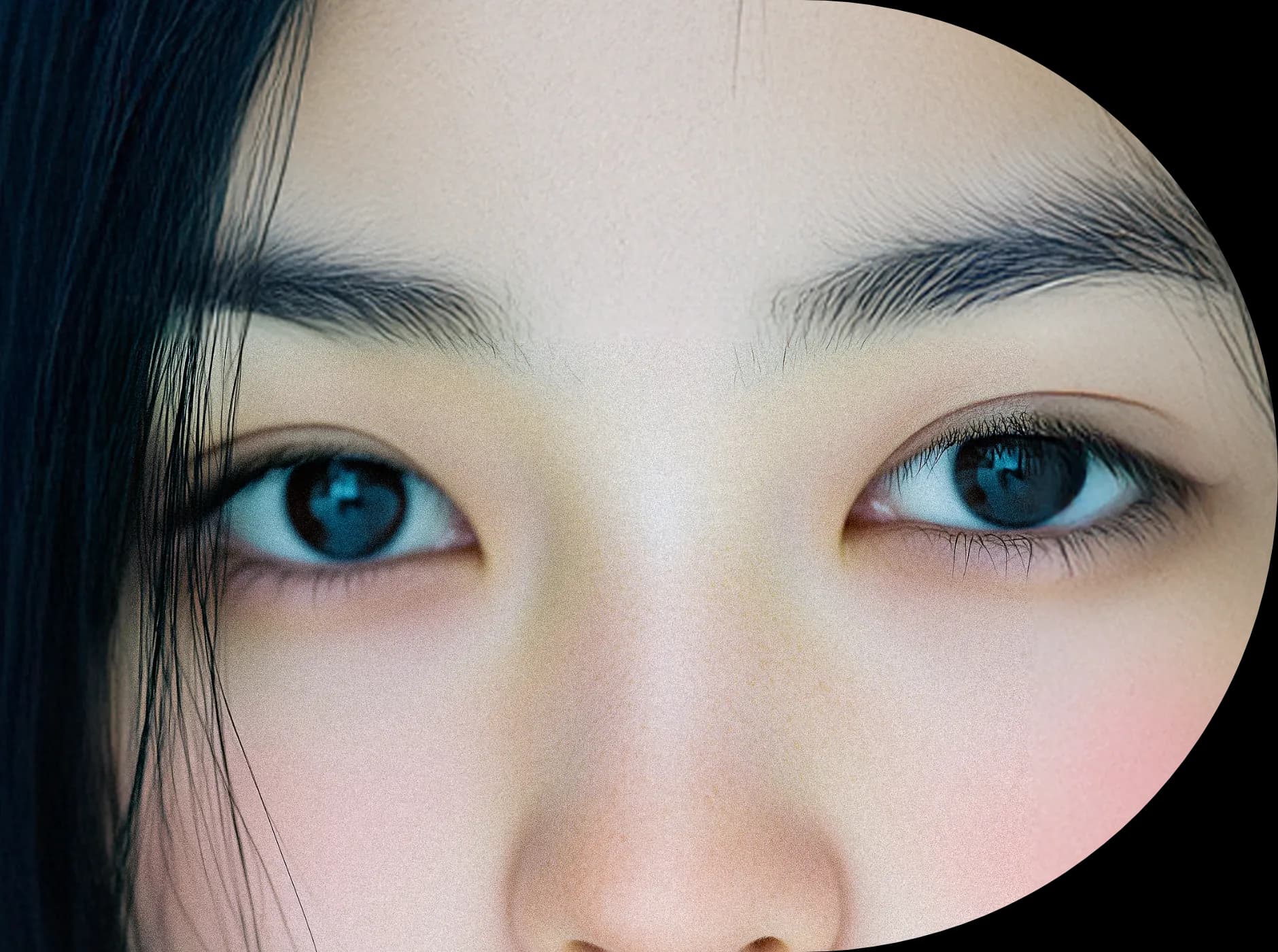 눈매교정 수술로 더 커진 눈 - 매력적인 눈매 변화