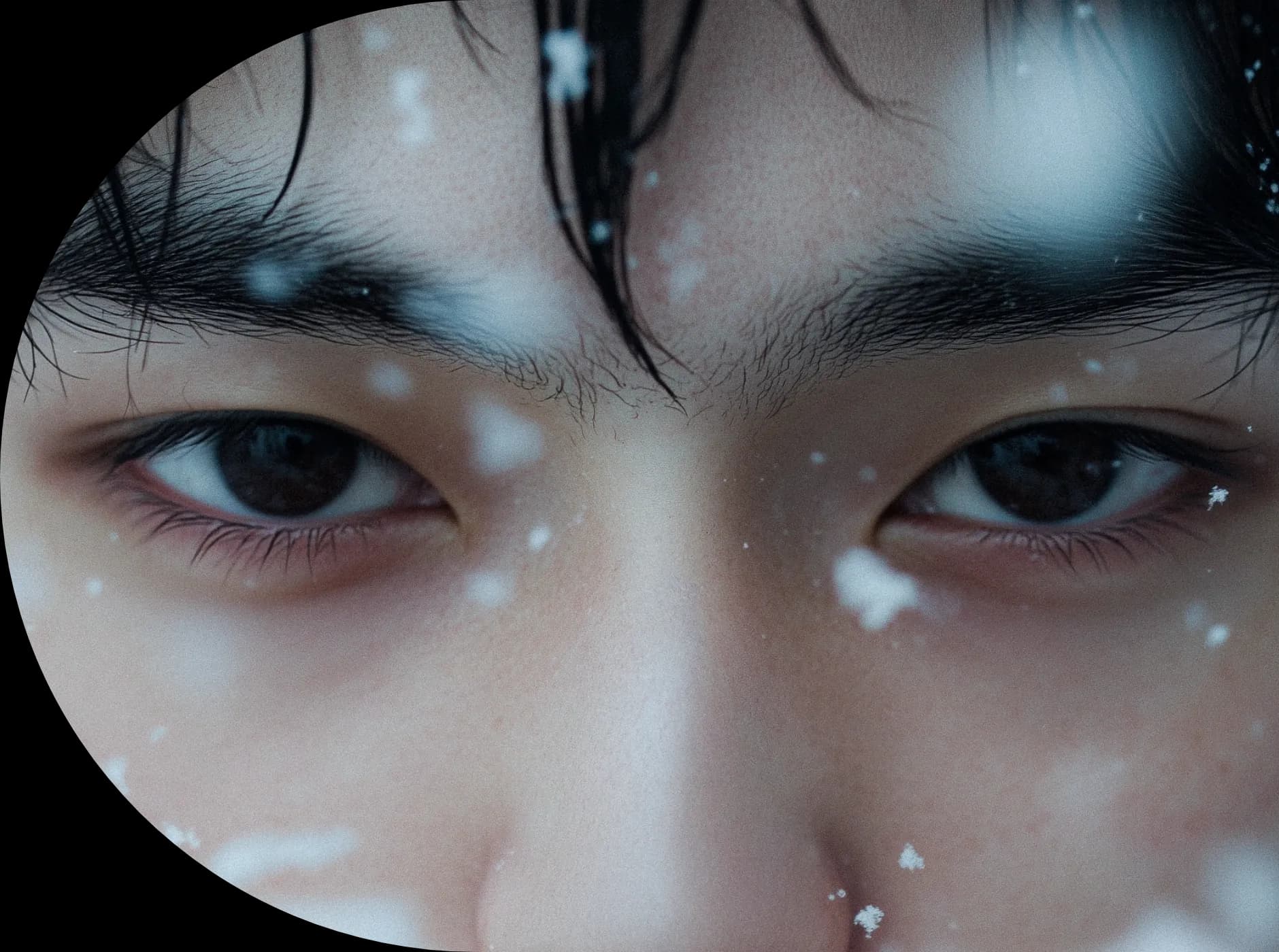 남자 눈매교정를 통한 인상의 변화