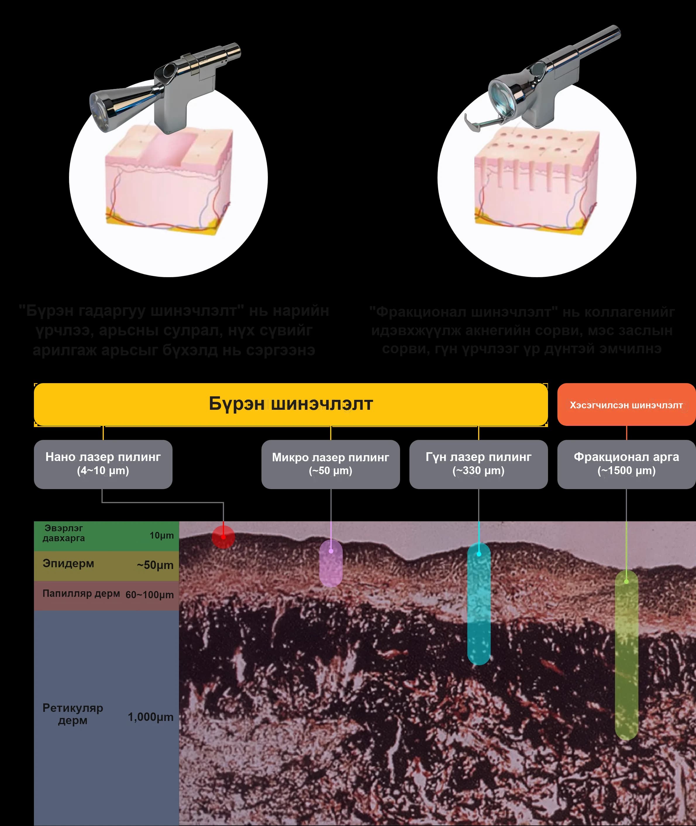 Sciton ZoomScan - full face facial resurfacing treatment/Sciton Profractional - fractional resurfacing laser/laser peeling with Sciton