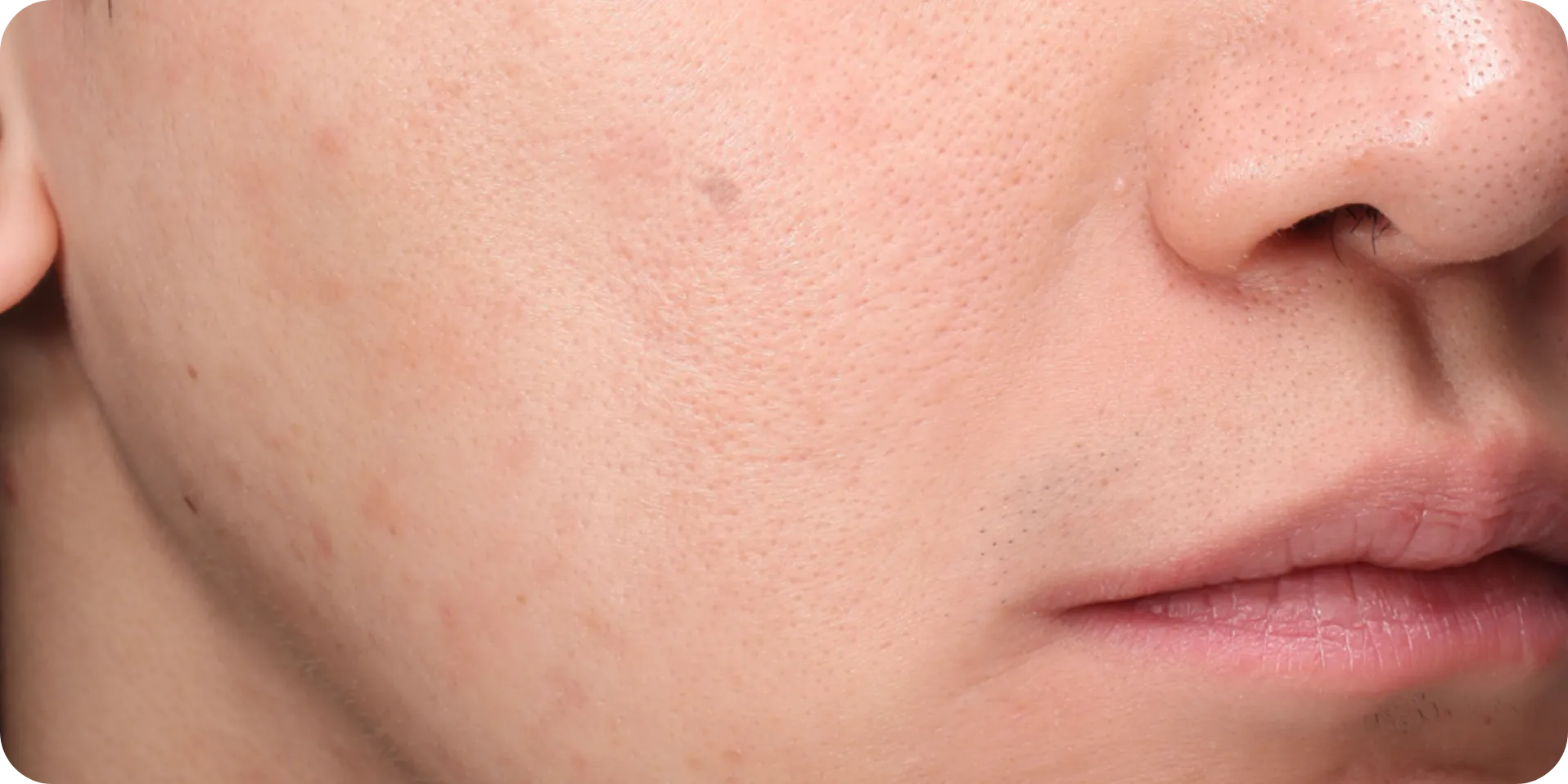 Gros plan de ridules et de texture cutanée